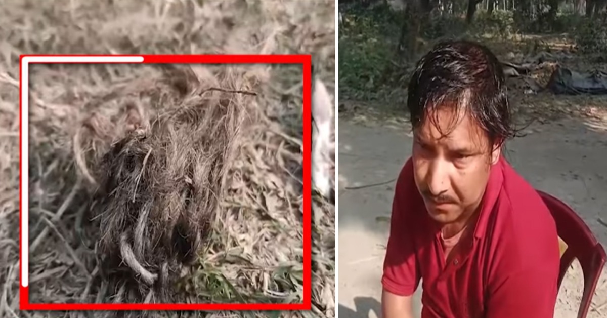 ফের ভাঙড়ে বোমাবাজি! ঝলসে গেল তৃণমূলকর্মীর হাত