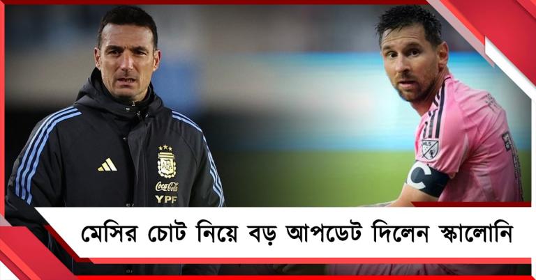 মেসির চোট কতটা উদ্বেগজনক? বড় আপডেট দিলেন স্কালোনি
